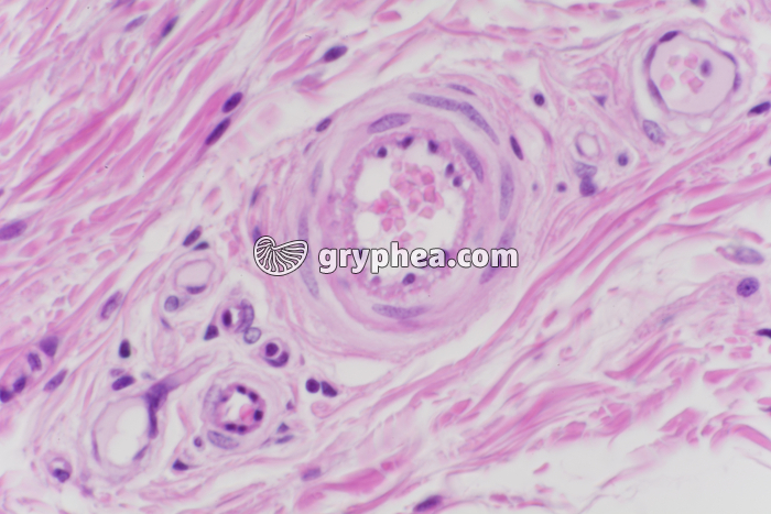 Vaisseaux lymphatiques x200 - gryphea.org